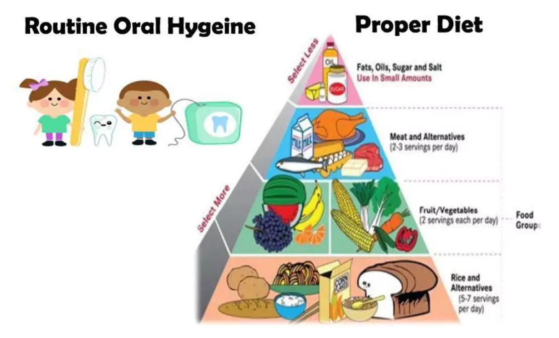 Face N Dental International Clinic in Nigdi Pimpri Chinchwad decay Preventive Measures