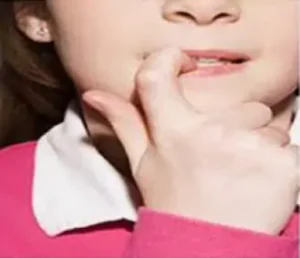Face N Dental International Clinic in Nigdi Pimpri Chinchwad Nail Biting