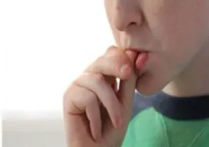 Face N Dental International Clinic in Nigdi Pimpri Chinchwad Lip Habits