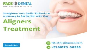 Face N Dental Clinic aligners treatment in Nigdi Pimpri Chinchwad