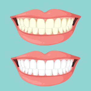 Face N Dental Clinic Smile Makeover in Nigdi Pimpri Chichwad