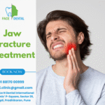 Face N Dental International Clinic Best Jaw Surgery in Pimpri Chinchwad