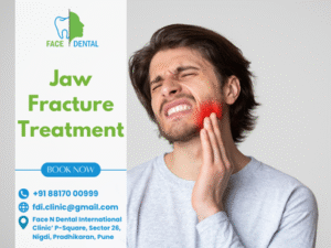 Face N Dental International Clinic Best Jaw Surgery in Pimpri Chinchwad