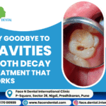 Face N Dental International Clinic tooth decay treatment in Pimpri Chinchwad