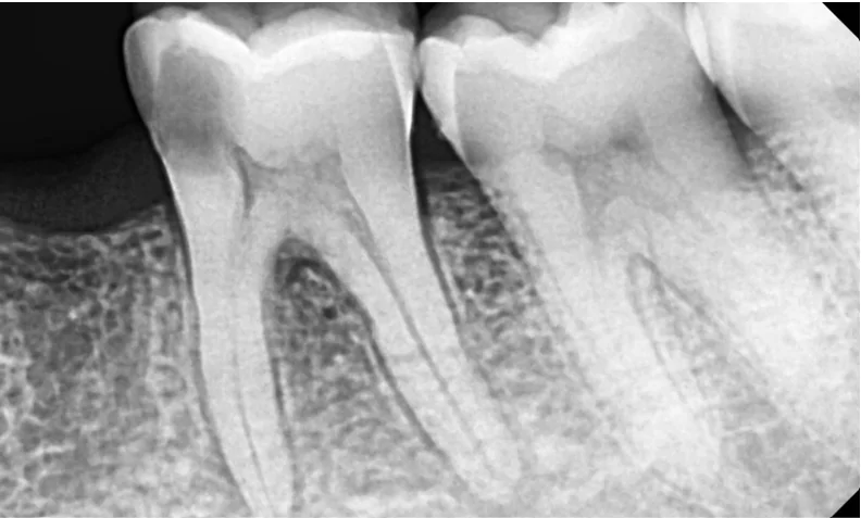 Face N Dental International Clinic in Nigdi Pimpri Chinchwad R.V.G Image2