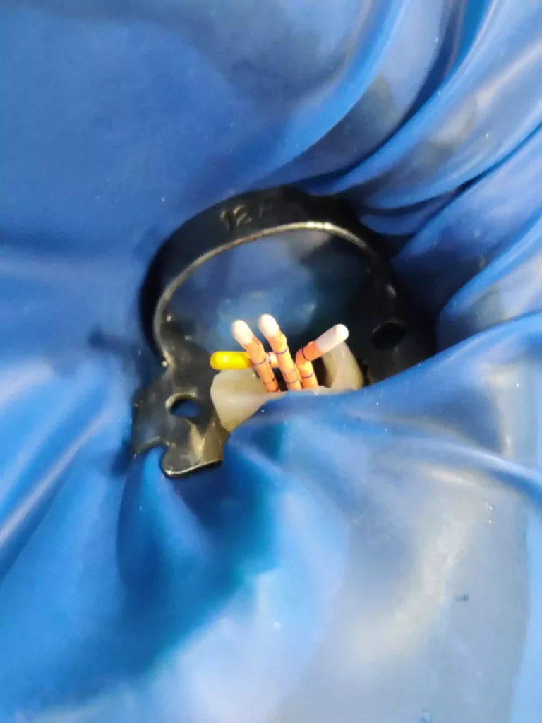 Face N Dental International Clinic Advance Root Canal Treatment in Nigdi Image2