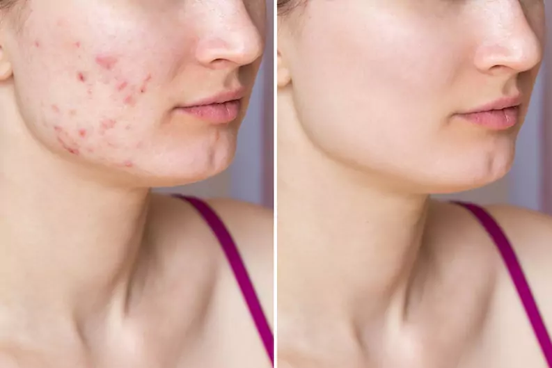 Face N Dental International Clinic in Nigdi Pimpri Chinchwad cosmetology services1
