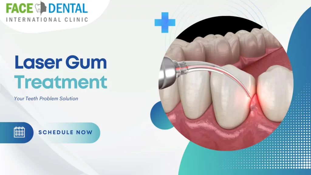 Laser Gum Treatment in Nigdi Pune Face N Dental International Clinic