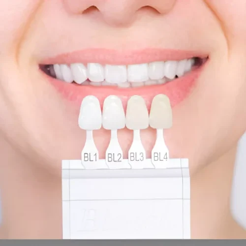 Face N Dental International Clinic in Nigdi Pimpri Chinchwad Replacement of Missing Teeth