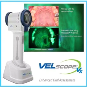Face N Dental International Clinic in Nigdi Pimpri Chinchwad Velscan Machine – Pre-Cancer Detection8