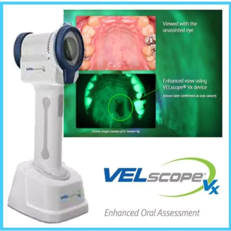 Face N Dental International Clinic in Nigdi Pimpri Chinchwad Velscan Machine – Pre-Cancer Detection8