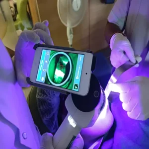 Face N Dental International Clinic in Nigdi Pimpri Chinchwad Velscan Machine – Pre-Cancer Detection5