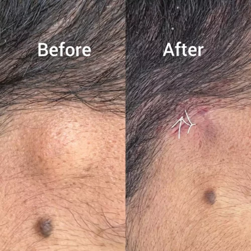 Face N Dental International Clinic in Nigdi Pimpri Chinchwad cosmetology services3