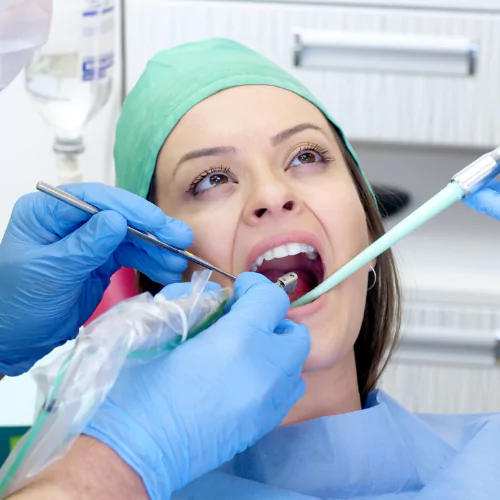 Face N Dental International Clinic in Nigdi Pimpri Chinchwad Pain Free Wisdom Tooth Surgery