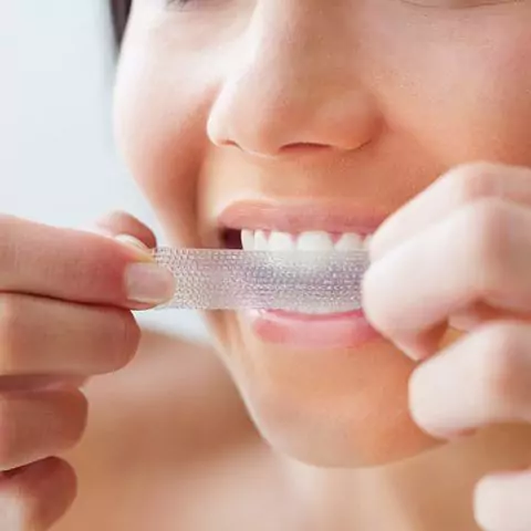 laser teeth whitening equipment