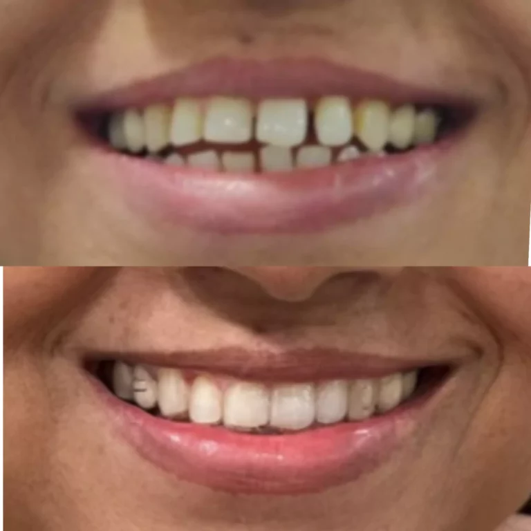 Face N Dental International Clinic in Nigdi Pimpri Chinchwad orthodontic treatment