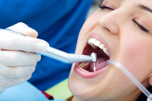 teeth cleaning services at Face N Dental International Clinic in Nigdi Pimpri Chinchwad